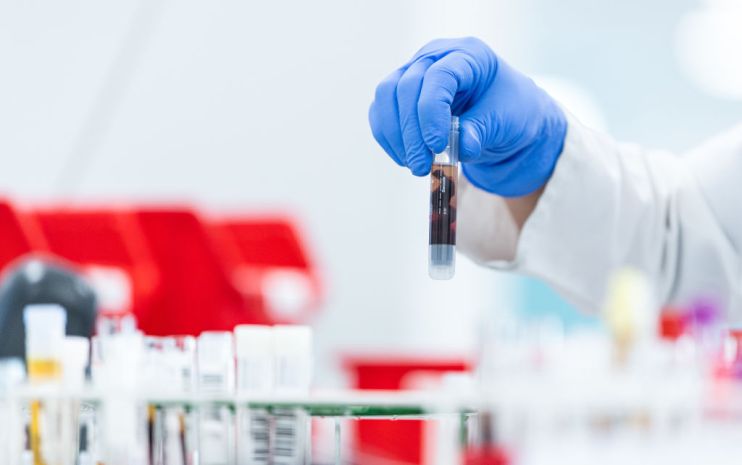 NRW Governor Laschet Visits Coronavirus Testing Lab