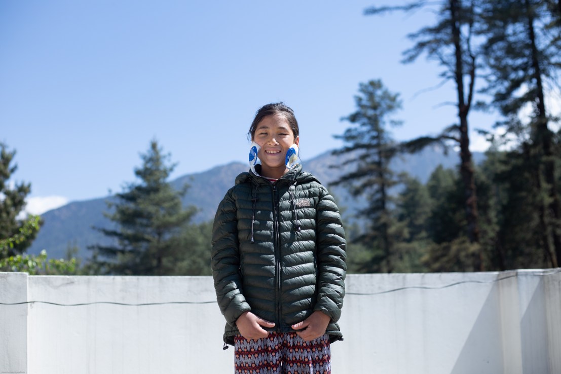 A child in Nepal poses after receiving sight-saving cataract surgery.
